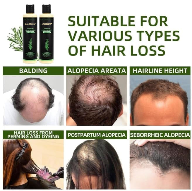 🔥LAST DAY 50% OFF - 🎅Dazzlira® Organic Rosemary Hair Growth Shampoo Designed & Developed in Los Angeles, CA Sh
