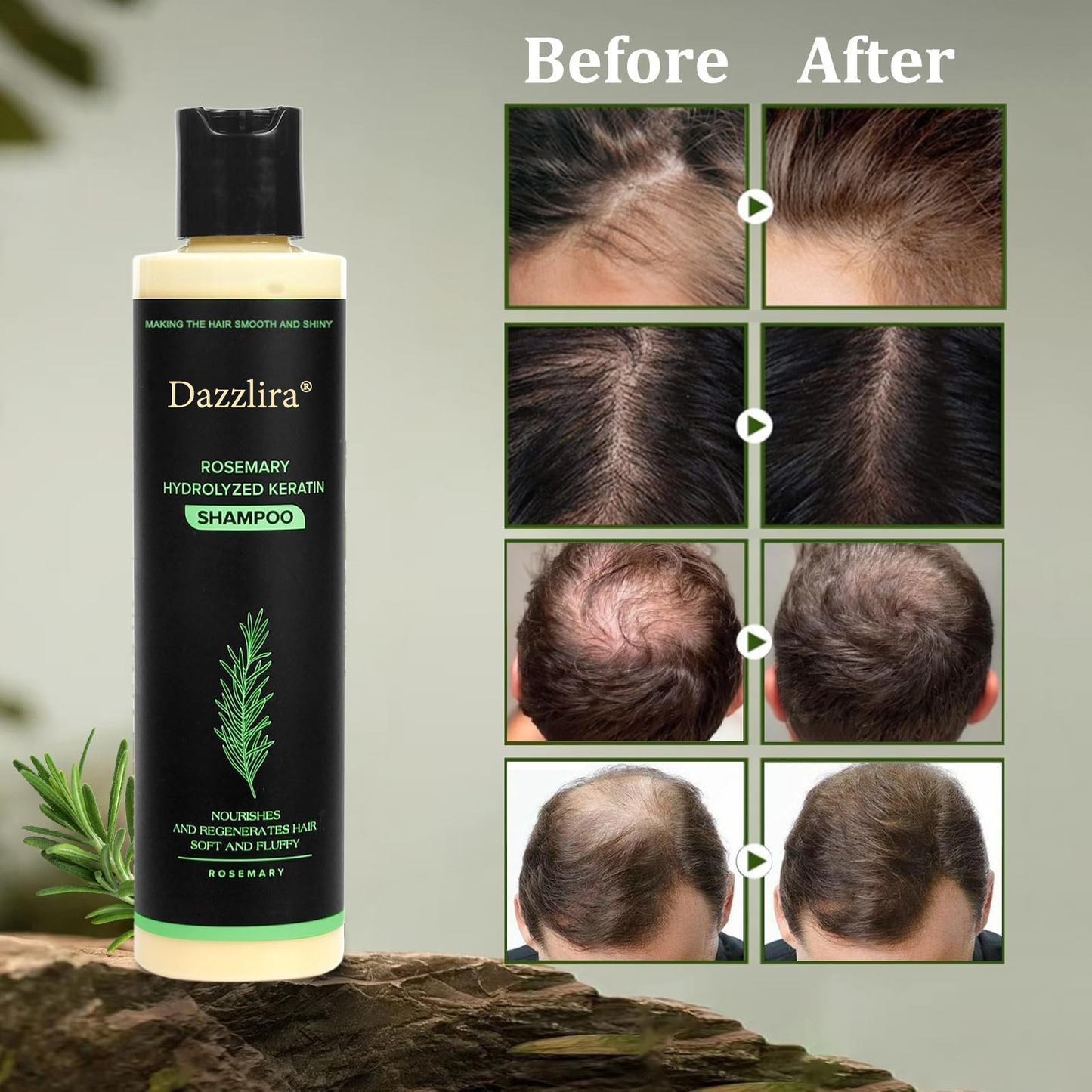 🔥LAST DAY 50% OFF - 🎅Dazzlira® Organic Rosemary Hair Growth Shampoo Designed & Developed in Los Angeles, CA Sh